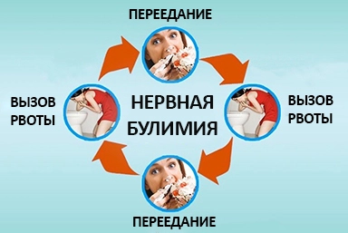 Лечение булимии в Карагае